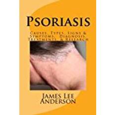 Psoriasis: PSORIASIS Causes, Types, Signs & Symptoms, Diagnosis, Treatments, & Research