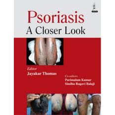 Psoriasis: A Closer Look (Paperback, 2014)