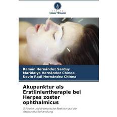 Bücher Akupunktur als Erstlinientherapie bei Herpes zoster ophthalmicus