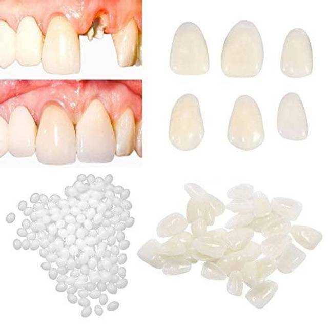 TEMPORARY TEETH TooTH REPAIR KIT * Cosmetic Repair * 30 teeth. IT REALLY  WORKS!